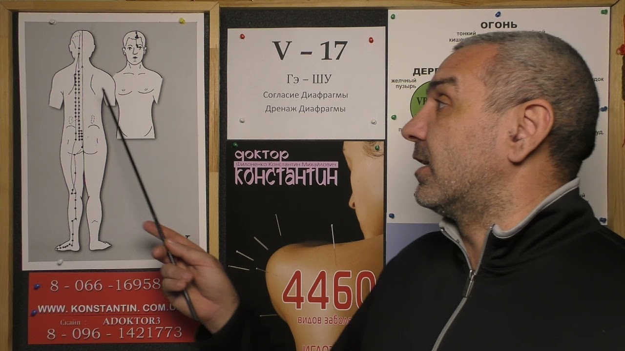 Костный Туберкулез.