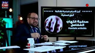 مرض الصدفية {جلدية} دكتور جودة محمد عواد | دكتور جودة محمد عواد