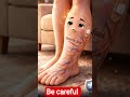 diabetic foot #everyone #modicare #diabetic #diabeticfootcare #selfcare#behealthy