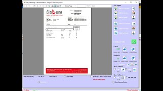 Culture Test Antibiotics Easy Pathology Lab - Latest Medical Laboratory Software SMS Email, What-App screenshot 5