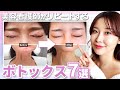 【美容レポ】美容看護師が行う定期メンテナンス、ボトックスについて。CS、施術風景、ダウンタイム、美容レポ