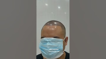 Xăm tóc cho anh,  chị, em tóc thưa do rụng tóc.tạo dáng theo sở thích của khách style châu âu