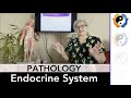 Endocrine System Pathologies