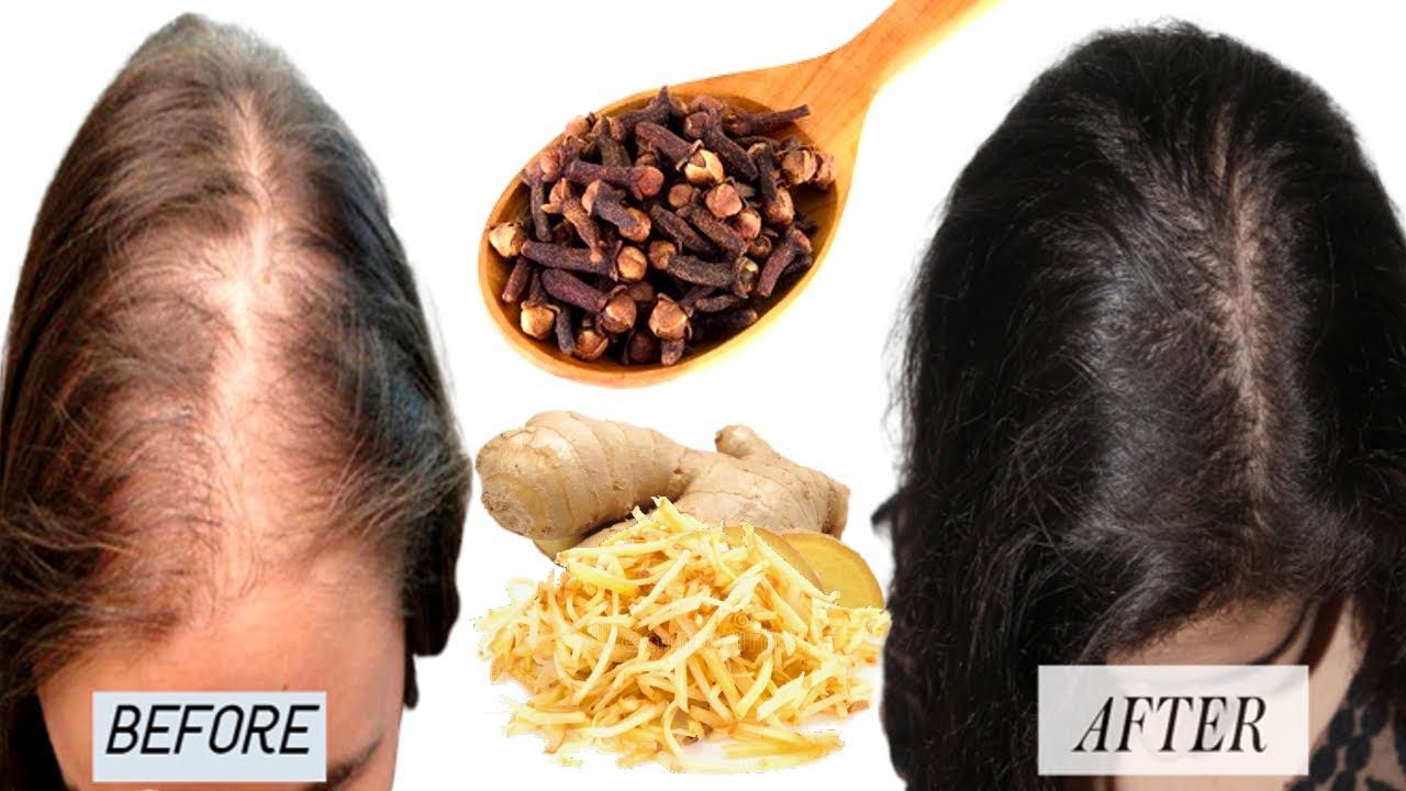 Mix Cloves with Ginger For Regrow Lost Hair- Get Thick Long Hair- Fast ...