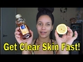 DIY Face Mask | Clear Skin With Honey & Lemon