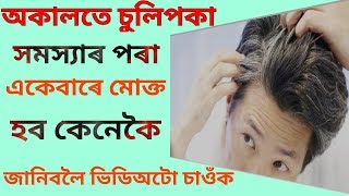      premature Greying Of Hair Treatmentdr Haris Well Future