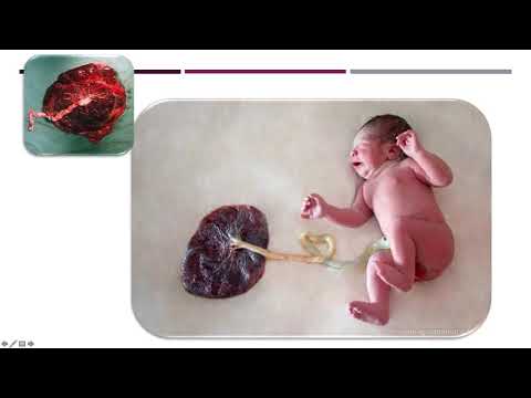 Vídeo: Transcriptoma Livre De Células Do Líquido Amniótico: Um Vislumbre Do Desenvolvimento Fetal E Da Dinâmica Celular Da Placenta Durante A Gravidez Normal