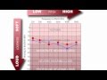 How to read an audiogram