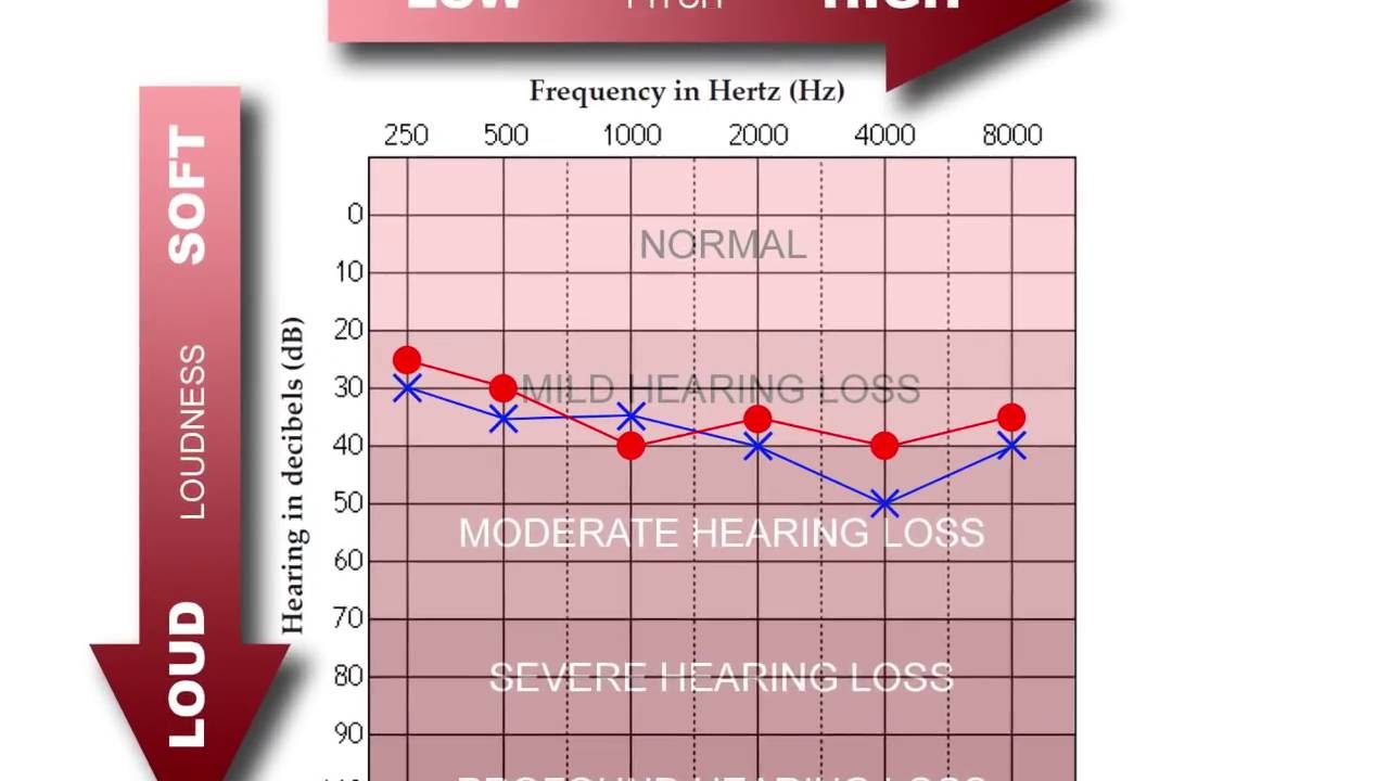 Normal Hearing Range Chart