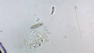Microscope madness