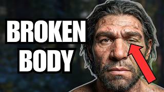 This Neanderthal Should Not Have Survived...But He Did