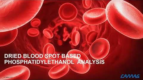 Fully Automated Analysis of Phosphatidylethanol from Dried Blood Spots with Hematocrit Correction