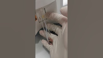 HDL Good Cholesterol testing #bloodchemistry #laboratory #mls #cls #medtechstudent #chemistry #mlt