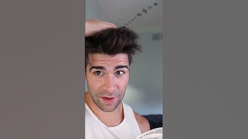 I Tried Everything For HAIRLINE GAINS