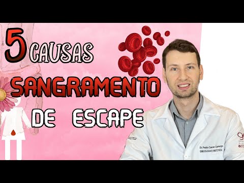 Vídeo: O sangramento de escape é comum?