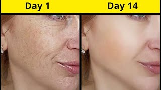 Korean Anti Aging Secret To Look 10 Years Younger Than Your Actual Age - Remove Wrinkles And Spots