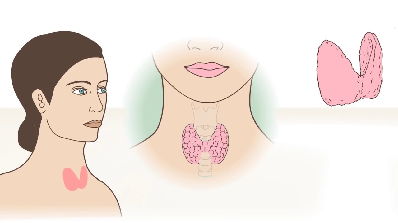 Bolje sprečiti dr Tatjana Pavlović Rak štitne žlezde