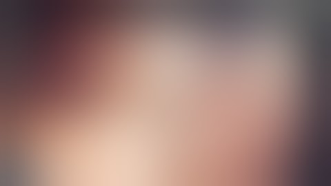 Laproscopic assisted ERCP in Gastric Bypass/Roux en-Y