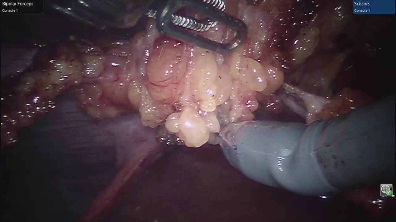 video phone é a continuação de telephone Rives Stoppa