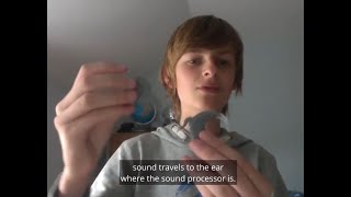 Harry explains how his CI works