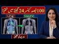 No.1 Oncologist Reveals the SIMPLE Daily Habit That Prevents Cancer After 50!Dr Nimra official