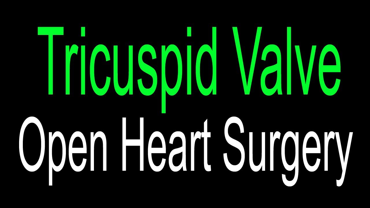 Tricuspid Valve Open heart Surgery Urdu/Hindi YouTube