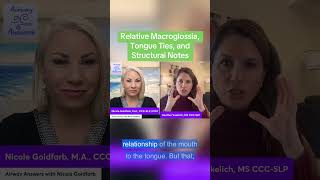 Relative Macroglossia, Tongue Ties, &amp; Structural Notes #downsyndrome #downsyndromebaby #tonguetie #b