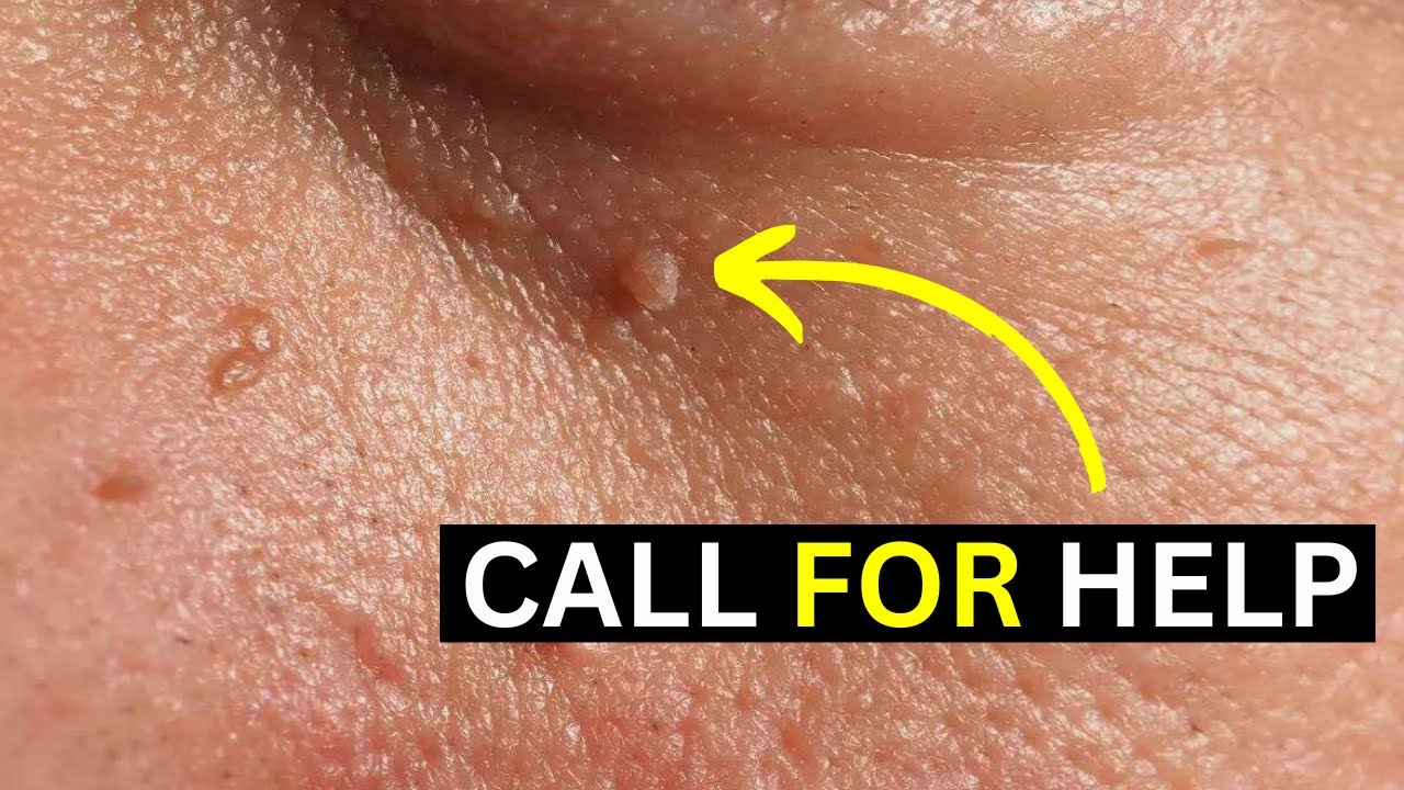 8 Warning Signs And Symptoms Of Diabetes