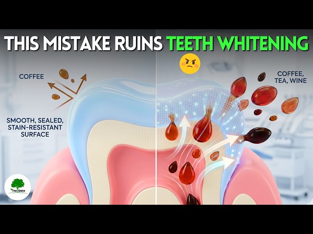 Nobody Told You This Simple Mistake Destroys Teeth Whitening Results ⚠️