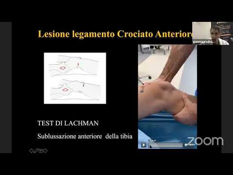ricostruzione del legamento crociato e riabilitazione - YouTube