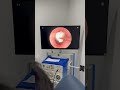 Thick Earwax Disaster Fixed 😳 | Professional Deep Ear Cleaning #ENTSpecialist #Shorts #Doctor