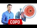 Chronic Obstructive Pulmonary Disease (COPD)