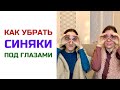 Как убрать синяки под глазами | Александра Титкова