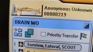 Parameters, CT head/brain scan | Philips CT machine, CAT SCAN, protocols