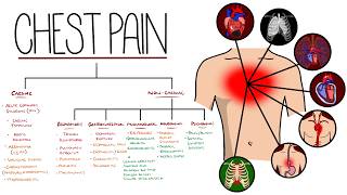 Approach to Chest Pain Made Easy