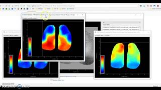 Details MBE Tutorial Part 3: Coordinates, SPC maps, Matrices News