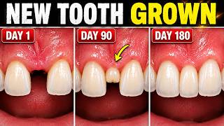 Can You Grow a New Tooth? Japan’s New Tooth-Growing Drug ! 2026 Update