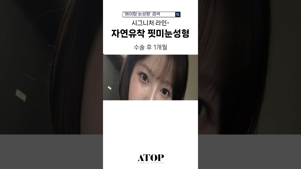 [Эйтоп Гоо сайхны мэс засал] Эйтоп Байгалийн наалтын нүдний мэс заслын бодит сэтгэгдэл   #ГаннамСтанцынГооСайхныМэсЗасал #ДавхарЗовхиныСэтгэгдэл #ДавхарЗовхиныБодитСэтгэгдэл #ДавхарЗовхиныМэсЗаслынСэтгэгдэл