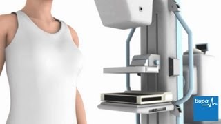 How a mammogram is carried out