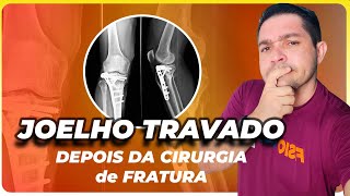 Joelho Duro Para Dobrar Após Cirurgia De Tíbia Entenda E Conheça A Goniometria