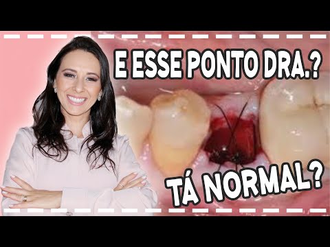 TIREI O DENTE E O PONTO ESTÁ ESTRANHO, SERÁ NORMAL? Dra. Jaque Akemi - Londrina-PR