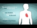 What is a Heart Murmur and How Does it Relate to Valve Problems?