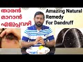 Amazing Natural Remedy For Dandruff,  താരൻ മാറാൻ നാച്ചുറൽ മരുന്ന് പരിചയ പെടാം,  Dandruff Remedy