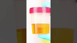 Pregnancy Kit Test - Dr. Monika Rajput #gynecologist #pregnancy #pregnancytest #pregnancytips