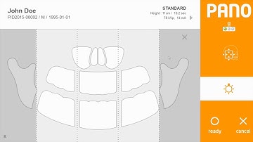 RAYSCAN : Utilisation et manipulations (EN)