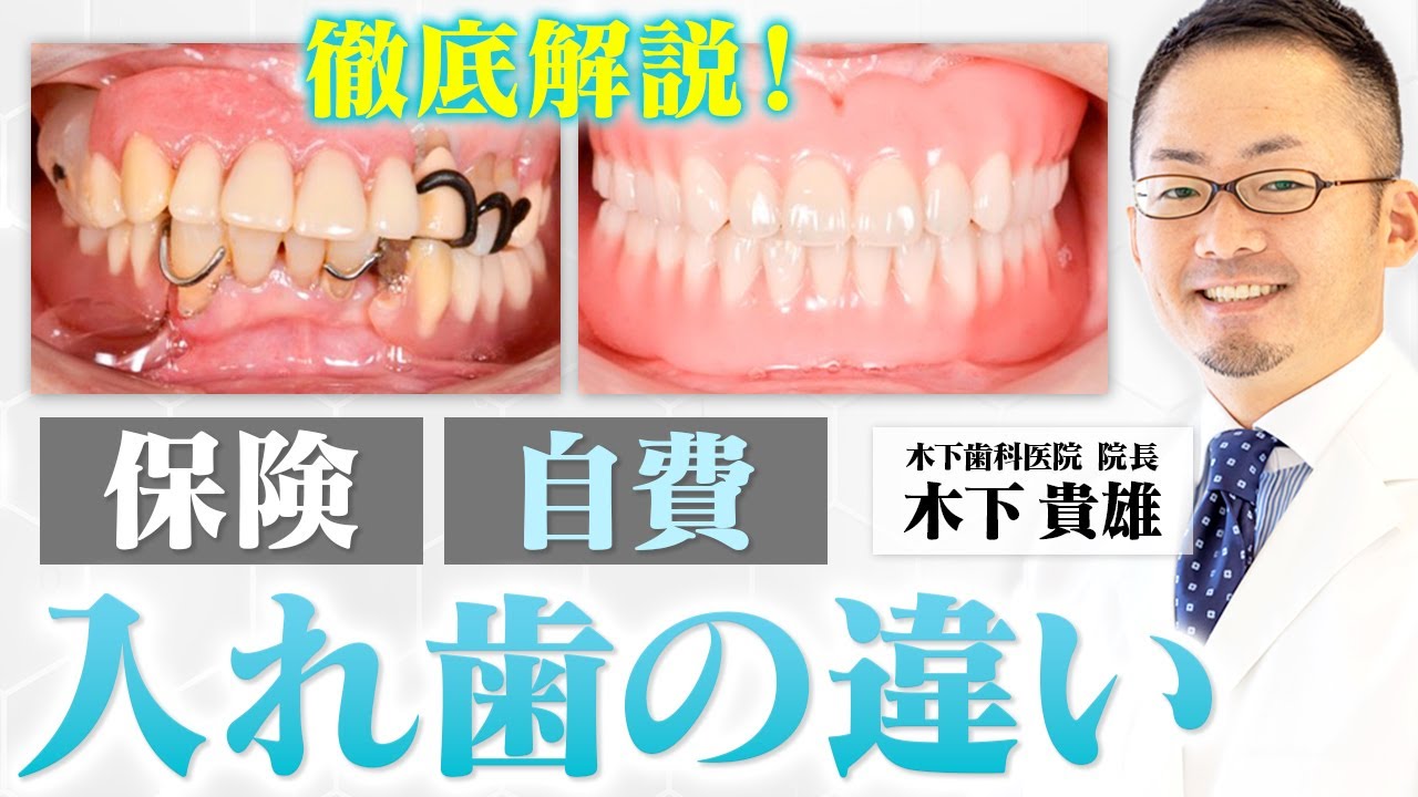 【保険入れ歯】今の入れ歯で満足できますか？保険診療と自由診療の入れ歯の違いを解説します