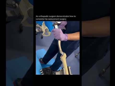 How Do Surgeons Replace a Hip in Under an Hour?