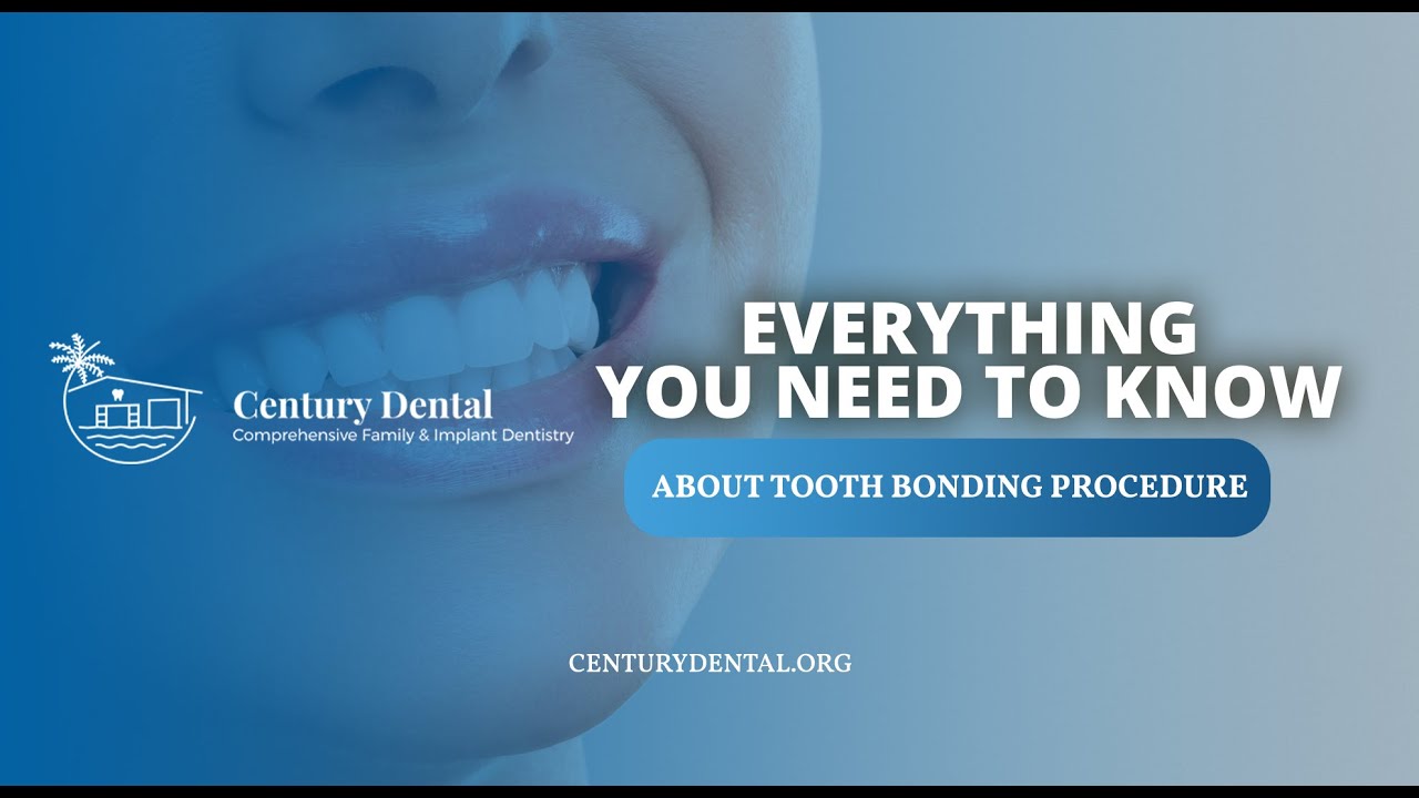 Everything You Need To Know About Tooth Bonding Procedure YouTube