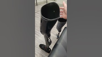 Magic of alignment when in prosthetics