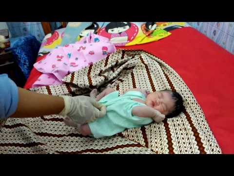 Thumbnail for bayi lucu baru 5 menit keluar dari rahim langsung di bedong